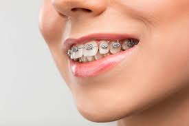 Orthodontic