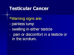 Roswell park comprehensive cancer center recommends that males between the ages of 15 and 50 do a. Quiz Lets See How Much You Already Know