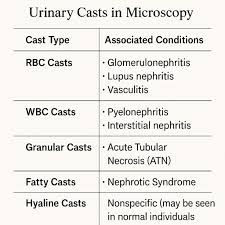 Image result for Urinary Cast