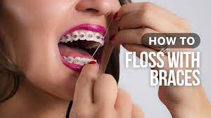 While there are many brands and types of floss that work with a threader, you may find a waxed floss approved by the american dental association is less likely to shred and easier to use. How To Floss With Braces Youtube