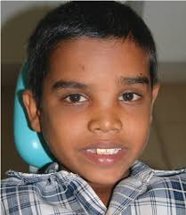 Check spelling or type a new query. Site Of Millipede Bite On The Forehead With Diffuse Swelling Involving Download Scientific Diagram