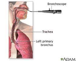 Diagnostic Testing