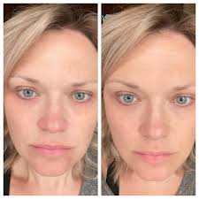 What's the difference between the two images?