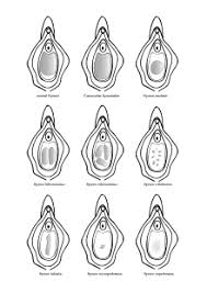 You might bleed slightly or you might bleed heavily. Hymen Wikipedia