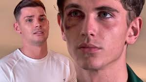 Anyone else think Lucas looks like a young Ste?