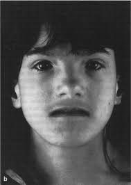 Alkohol und Schwangerschaft