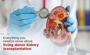 Image result for Transplantation