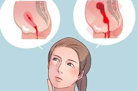 Thai chết lưu: Nguyên nhân, triệu chứng, chẩn đoán và điều trị