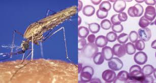 Image result for Malaria