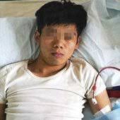 Mladík prodal ledvinu, aby měl na iPhone, teď je invalida