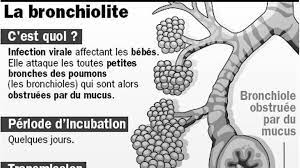 Le nuove linee guida sulla bronchiolite. Bronchiolite Du Nourrisson Alerte Dans Les Urgences