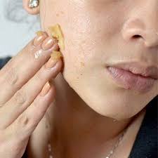 Epingle Sur Masque Anti Acne