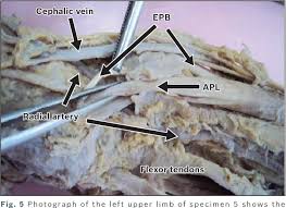 Check spelling or type a new query. Pdf Multiple Variations Of The Tendons Of The Anatomical Snuffbox Semantic Scholar