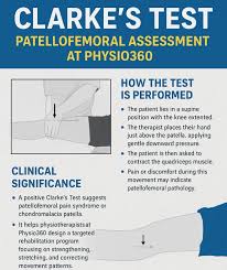 Image result for Patella Tracking Assessment