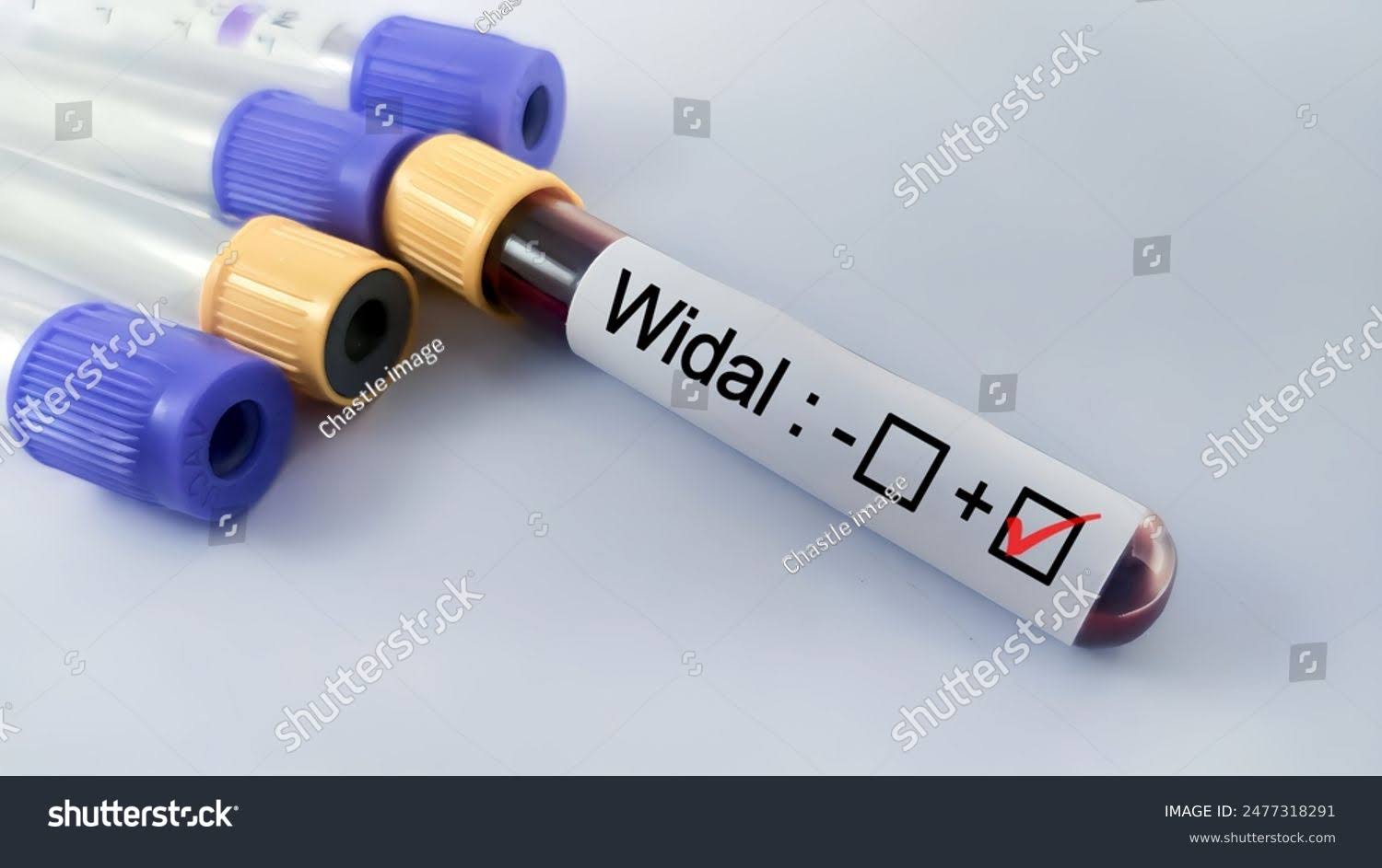 WIDAL SLIDE product image