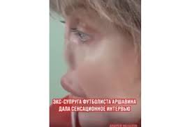 Леша ✌️ (2004 год), алиса (2011), есеня (2017). Eks Supruge Arshavina Polnostyu Otrezali Nos Abn