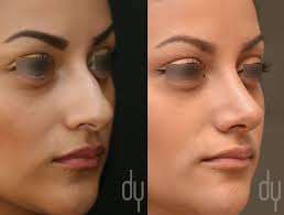 10 Best Straight nose ideas