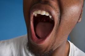 Image result for Fissured tongue