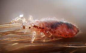 We use this opportunity to explain that head lice are human parasites which need human blood to survive. Safe And Effective Ways To Get Rid Of Head Lice Lawnstarter