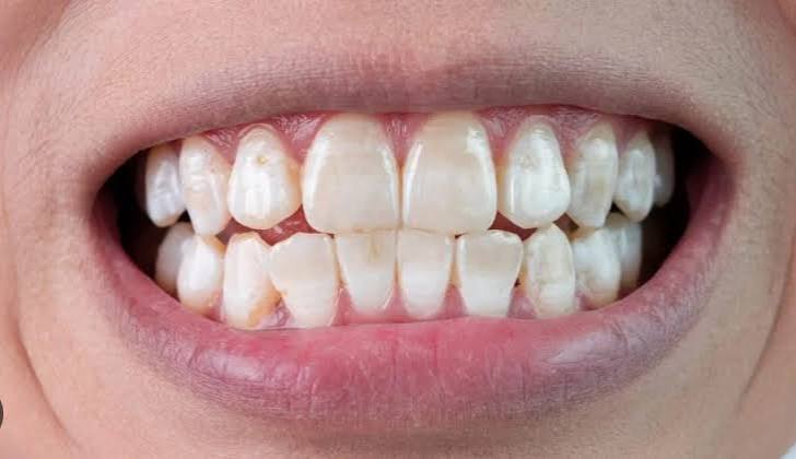 My Child's Tooth Turned Grey After a Fall | Dentistry Junior