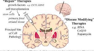 Figure 2 From Cell Therapy In Huntington Disease Semantic Scholar