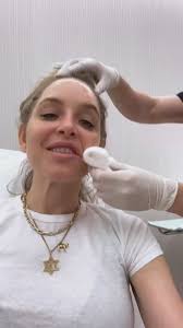 I tried @sofwavemed yesterday w @drdanbelkin and then made him go to dinner  with me at @shmonenyc . Will report back to the group with results.