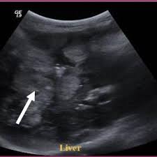 Changes in your dog's bathroom behavior could potentially indicate cancer in the bladder or kidneys. Pdf Ultrasonographic Diagnosis Of Liver And Gallbladder Surgical Affections In Dogs And Cats