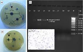 We would like to show you a description here but the site won't allow us. Antibacterial Aryl Crowned Polyketide From Bacillus Subtilis Associated With Seaweed Anthophycus Longifolius Chakraborty 2018 Journal Of Applied Microbiology Wiley Online Library