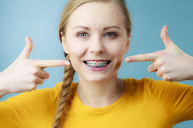 Invisalign is a great way to straighten your teeth without the hassle or discomfort of traditional metal braces. 13 Things You Need To Know About Your First Week With Braces