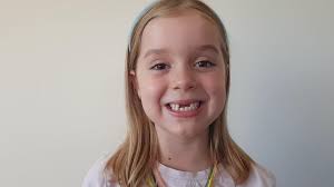 Correcting a lisp can sometimes take many months to a few years of speech therapy. Lisps In Children Youtube