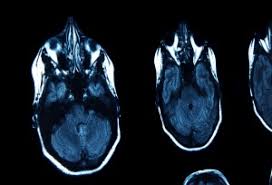 Learn the similarities and differences in the two scans and how you can prepare abdominal abnormalities: Blog What S The Difference Between An X Ray Ct Scan And Mri