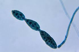 It is an opportunistic pathogen on numerous hosts causing leaf spots, rots and blights on many plant parts. Alternaria Wikipedia