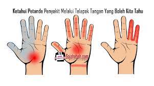 Menurut pakar palmistry (membaca garis tangan) dan penulis buku read his hands, know his heart, marion gale, dengan hanya melihat telapak tangan lelaki, seseorang boleh mengetahui rahsia hati seorang lelaki. Ketahui Petanda Penyakit Melalui Telapak Tangan Yang Boleh Kita Tahu