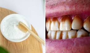 These gels contain some amount of peroxide, which has mild bleaching powers enabling to remove stains from teeth to an extent. How To Get Rid Of Brown Stains On Your Teeth Using Baking Soda Express Co Uk