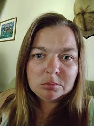 Why do eyes look like this after a storm?