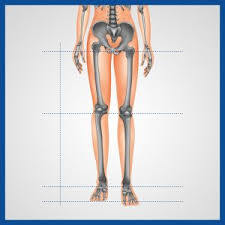Image result for Functional Leg Length Discrepancy