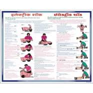 Electric Shock Treatment Chart Buy Electric Shock