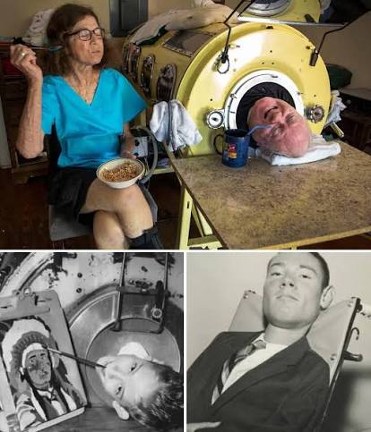 Mr Paul Alexander was left paralysed from the neck down in 1952 and spent  the rest of his life inside the cylinder.