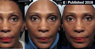 Trade in flabby, fat cheeks for defined cheekbones by following these steps: Facial Exercises May Make You Look 3 Years Younger The New York Times