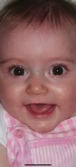 Australian Shepherd mix eye color change at 6 years old?