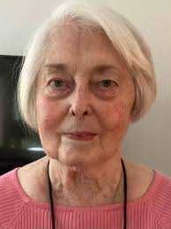 Blepharoplasty Support Group