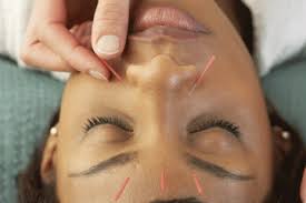 Some of which include laser caps, dht blocking shampoos, creams, topical treatments and more.one of the most successful, more natural, hair loss treatment remedies is the derma roller. Chinese Beauty Secrets Wellbeing Com Au