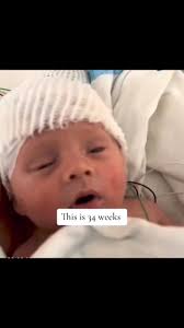 This is a baby at 34 weeks. The audio...