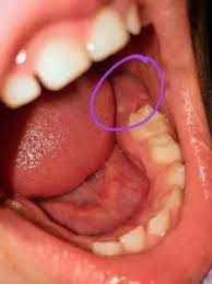 6 Year Molars What Every Parent Should Expect Toothbrush Life