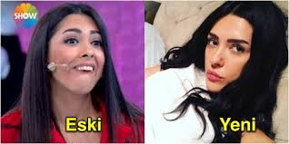 Ünzile aydın 135.162 views3 year ago. Bu Degisim Degil Yuz Nakli Iste Benim Stilim Yarismacisi Aysegul Dogan In Son Hali Sizi Cok Sasirtacak Paylasim Gazete Guncel Haber Paylasim Gazete Haber