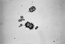 Microscopic Aspects Of Urinalysis And Discussion Of Selected Disease Processes Veterian Key