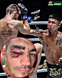 Muay Thai elbow strikes carry rich cultural significance