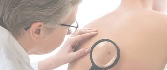 Some of the symptoms are similar to other conditions. Skin Cancer Prevention Treatment Affiliated Dermatology
