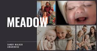 Dandy-Walker Alliance