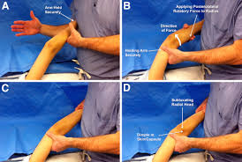 Anterior draw test ankle ligaments | clinical physio premium. Posterolateral Rotatory Instability Of The Elbow Part I Mechanism Of Injury And The Posterolateral Rotatory Drawer Test Sciencedirect